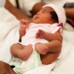 Everything You Want To Know About Clubfoot